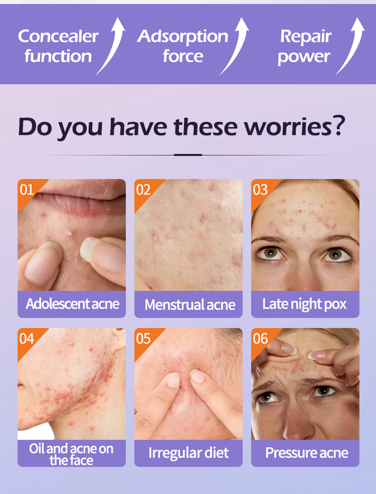 Acne Patch(图2)