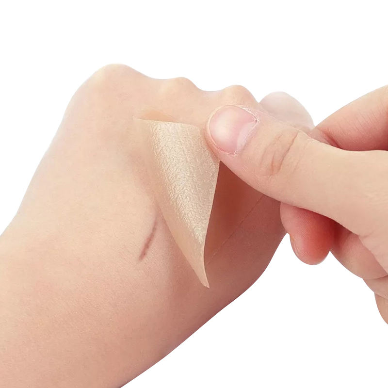 Kongdy|Silicone Scar Sheets